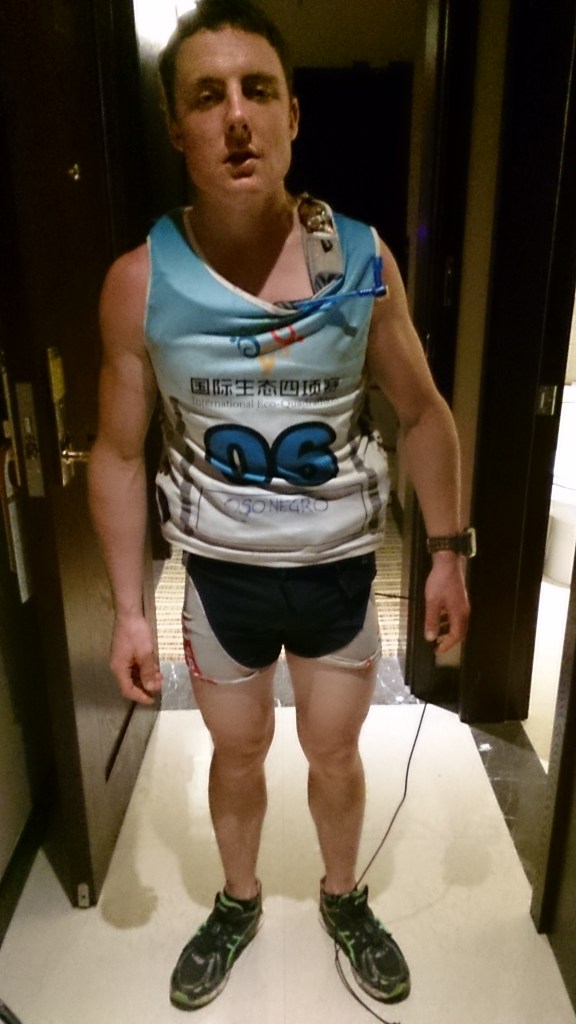 Tried the capture the damage before hitting the deck, photo doesn't do justice...